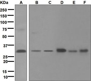 Western blot analysis on (A) HeLa, (B) JAR, (C) fetal muscle, (D) human brain, (E) human heart, and (F) human kidney lysates using anti-CSN7A antibody.