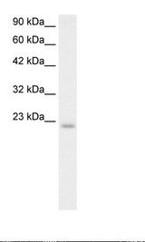 Daudi Cell Lysate