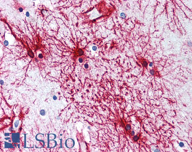 Anti-GFAP antibody IHC of human brain, cortex, astrocytes. Immunohistochemistry of formalin-fixed, paraffin-embedded tissue after heat-induced antigen retrieval. Antibody LS-B2192 concentration 5 ug/ml.