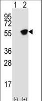 Western blot of GFAP (arrow) using rabbit polyclonal GFAP Antibody (T396). 293 cell lysates (2 ug/lane) either nontransfected (Lane 1) or transiently transfected (Lane 2) with the GFAP gene.