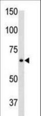 The anti-GFAP C-term antibody is used in Western blot to detect GFAP in mouse brain tissue lysate.