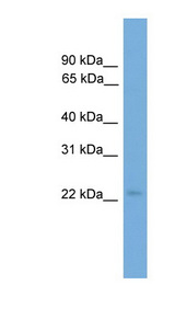 COPS8 antibody LS-C116463 Western blot of HepG2 cell lysate.