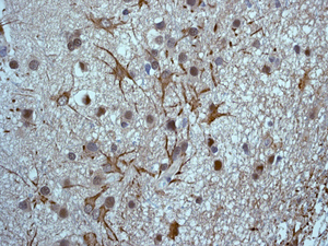 IHC of paraffin-embedded human brain tissue using anti-COPS8 antibody. 