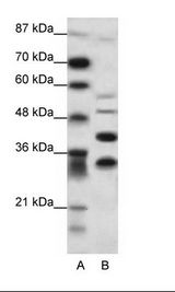 A: Marker, B: HepG2 Cell Lysate