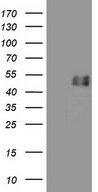 HEK293T cells were transfected with the pCMV6-ENTRY control (Left lane) or pCMV6-ENTRY GFI1 (Right lane) cDNA for 48 hrs and lysed. Equivalent amounts of cell lysates (5 ug per lane) were separated by SDS-PAGE and immunoblotted with anti-GFI1.