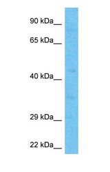 Western blot of GFI1 Antibody with human Jurkat Whole Cell lysate.
