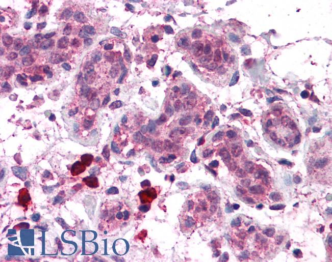 Anti-COPS8 antibody IHC of human breast. Immunohistochemistry of formalin-fixed, paraffin-embedded tissue after heat-induced antigen retrieval. Antibody LS-B4592 concentration 5 ug/ml.