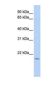 POLE3 antibody LS-C102743 Western blot of Fetal Lung lysate.