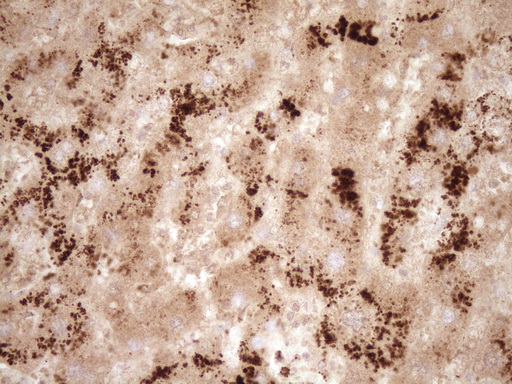 IHC of paraffin-embedded Human liver tissue using anti-GFI1 mouse monoclonal antibody. (Heat-induced epitope retrieval by 1 mM EDTA in 10mM Tris, pH8.5, 120°C for 3min).