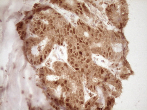 IHC of paraffin-embedded Human colon tissue using anti-GFI1 mouse monoclonal antibody. (Heat-induced epitope retrieval by 1 mM EDTA in 10mM Tris, pH8.5, 120°C for 3min).