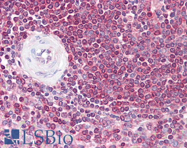 Anti-GFI1 antibody IHC of human spleen. Immunohistochemistry of formalin-fixed, paraffin-embedded tissue after heat-induced antigen retrieval. Antibody LS-B7250 concentration 5 ug/ml.