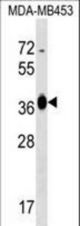 GFOD2 Antibody western blot of MDA-MB453 cell line lysates (35 ug/lane). The GFOD2 antibody detected the GFOD2 protein (arrow).