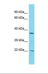 Western blot of Human COLO205. COPZ1 antibody dilution 1.0 ug/ml.