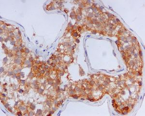 IHC of paraffin-embedded human testis tissue using anti-GFAT1 antibody.