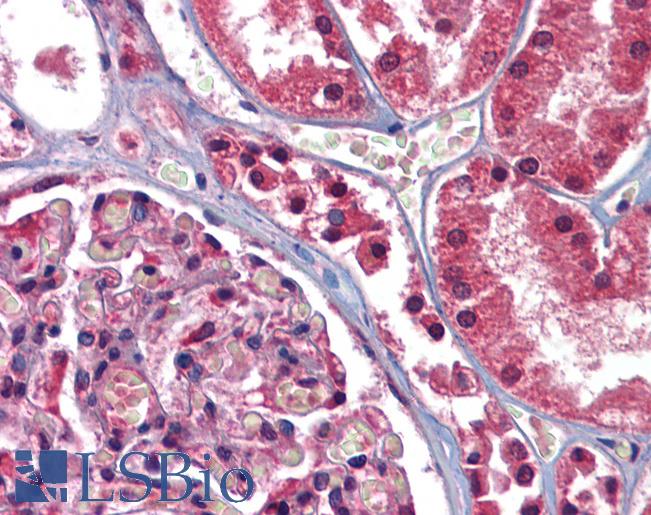 Anti-GFPT1 antibody LS-A9977 IHC of human kidney. Immunohistochemistry of formalin-fixed, paraffin-embedded tissue after heat-induced antigen retrieval.