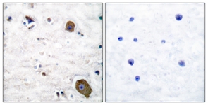 IHC of paraffin-embedded human brain tissue, using GFR alpha-1 Antibody. The picture on the right is treated with the synthesized peptide.