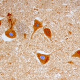 GFR alpha -1/GDNFR alpha -1 in Human Spinal Cord. GFR alpha -1/GDNFR alpha -1 was detected in immersion fixed paraffin-embedded sections of human spinal cord using Goat Anti-Human GFR alpha -1/GDNFR alpha -1 Antigen Affinity-purified Polyclonal Antibody at 15 ug/ml overnight at 4°C. Tissue was stained using Anti-Goat HRP-DAB (brown) and counterstained with hematoxylin (blue). Specific staining was localized to ventral horn motor neurons.