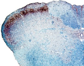 GFR alpha -1/GDNFR alpha -1 in Rat Spinal Cord. GFR alpha -1/GDNF R alpha -1 was detected in perfusion fixed frozen sections of rat spinal cord using Rat GFR alpha -1/GDNF R alpha -1 Monoclonal Antibody at 25 ug/ml overnight at 4°C. Tissue was stained using Anti-Mouse HRP-DAB (brown) and counterstained with hematoxylin (blue). Specific staining was localized to the dorsal horn.