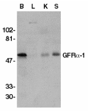 Western blot of GFRa-1 in crude membrane fractions of human brain (B), liver (L), kidney (K), and spleen (S), respectively, with GFRa-1 antibody at 1 ug/ml dilution.