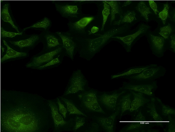 Immunofluorescence of monoclonal antibody to GFRA1 on HeLa cell . [antibody concentration 10 ug/ml]