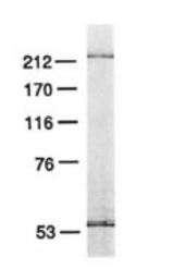 SDS-polyacrylamide gel analysis of HeLa DNA pol purified by Mono S FPLC. The Mono S fraction of HeLa DNA pol (0.1 mg) was electrophoresed on a 7% SDS-polyacrylamide gel and stained with silver.