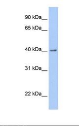 Fetal brain lysate. Antibody concentration: 1.0 ug/ml. Gel concentration: 12%.