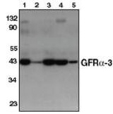 Western blot of GFR -3 antibody (LS-C26632) on mouse heart (1), spleen (2), kidney (3), liver (4) and brain (5).