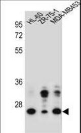 GFRA4 Antibody western blot of HL-60,ZR-75-1,MDA-MB453 cell line lysates (35 ug/lane). The GFRA4 antibody detected the GFRA4 protein (arrow).