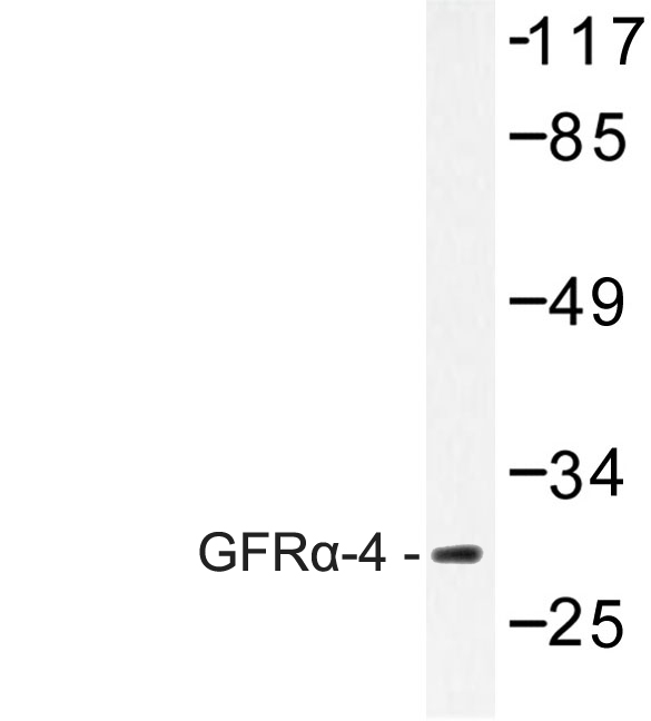 Western blot of GFR-4 (P178) pAb in extracts from HeLa cells.
