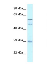 GFRA4 antibody LS-C145566 Western blot of 721_B Cell lysate. Antibody concentration 1 ug/ml.