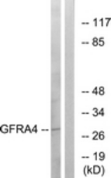 Western blot of extracts from HeLa cells, using GFRA4 Antibody. The lane on the right is treated with the synthesized peptide.
