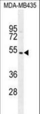 GFRAL Antibody western blot of MDA-MB435 cell line lysates (35 ug/lane). The GFRAL antibody detected the GFRAL protein (arrow).