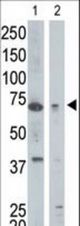 The anti-GGA1 antibody is used in Western blot to detect GGA1 in mouse kidney tissue lysate (lane 1) and Jurkat cell lysate (lane 2).