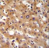 GGCX Antibody immunohistochemistry of formalin-fixed and paraffin-embedded human liver tissue followed by peroxidase-conjugated secondary antibody and DAB staining.