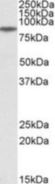 GGCX antibody (0.3 ug/ml) staining of Human Muscle lysate (35 ug protein in RIPA buffer). Primary incubation was 1 hour. Detected by chemiluminescence.