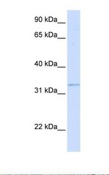 293T cell lysate. Antibody concentration: 1.0 ug/ml. Gel concentration: 12%.