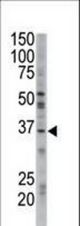 The anti-GGPS1 antibody is used in Western blot to detect GGPS1 in mouse brain tissue lysate.