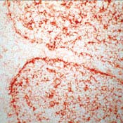 Human tonsil stained with anti-gamma glutamyl transferase
