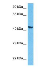 Western blot of COQ3 Antibody with human MCF7 Whole Cell lysate.