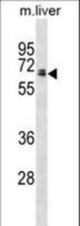 Rat Ggt1 Antibody western blot of mouse liver tissue lysates (35 ug/lane). The Rat Ggt1 antibody detected the Rat Ggt1 protein (arrow).