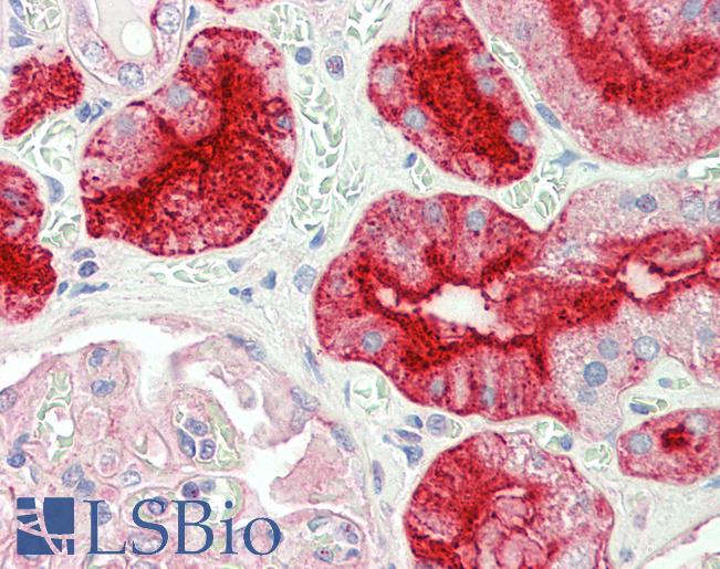Anti-GGT1 / GGT antibody IHC staining of human kidney. Immunohistochemistry of formalin-fixed, paraffin-embedded tissue after heat-induced antigen retrieval. Antibody LS-B11193 concentration 5 ug/ml.