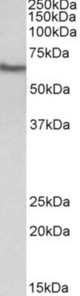 GGT1 antibody (0.3 ug/ml) staining of Human Kidney lysate (35 ug protein in RIPA buffer). Primary incubation was 1 hour. Detected by chemiluminescence.