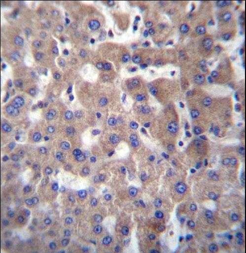 GGT2 Antibody immunohistochemistry of formalin-fixed and paraffin-embedded human liver tissue followed by peroxidase-conjugated secondary antibody and DAB staining.
