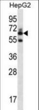 GGT2 Antibody western blot of HepG2 cell line lysates (35 ug/lane). The GGT2 antibody detected the GGT2 protein (arrow).