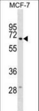 GGT6 Antibody western blot of MCF-7 cell line lysates (35 ug/lane). The GGT6 antibody detected the GGT6 protein (arrow).