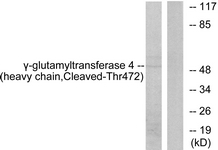 Western blot of extracts from Jurkat cells, treated with etoposide 25 uM 24h, using Gamma-glutamyltransferase 4 (heavy chain, Cleaved-Thr472) Antibody. The lane on the right is treated with the synthesized peptide.