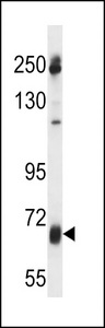 GGT7 Antibody western blot of uterus tumor cell line lysates (35 ug/lane). The GGT7 antibody detected the GGT7 protein (arrow).