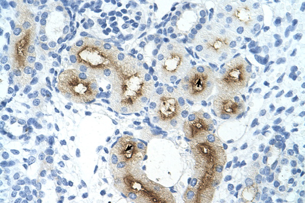 GGTLC1 / GGTLA4 antibody LS-C40336 IHC of formalin-fixed, paraffin-embedded human Kidney. Positive label: Epithelial cells of renal tubule indicated with arrows. Antibody concentration 4-8 ug/ml. Magnification 400X.