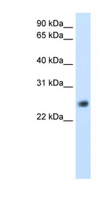 GGTLC1 / GGTLA4 antibody LS-C40336 Western blot of Fetal Kidney lysate.