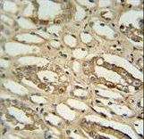 GGTLC2 antibody immunohistochemistry of formalin-fixed and paraffin-embedded human lung tissue followed by peroxidase-conjugated secondary antibody and DAB staining.